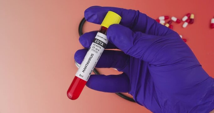 Scientific hand in blue PPE holds a Hantavirus specimen vial against a red backdrop. Highlighting the risk of viral infection and laboratory safety.
