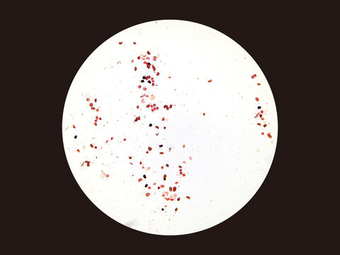 Ascaris is a parasitic nematode that infects humans via the fecal-oral route and resides in the small intestine. Each worm can produce 200,000 eggs per day. Magnify 40x.
