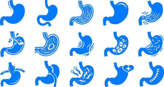 Set of stomach icon variations, human gaster anatomy flat design, digestive system medical UI illustration