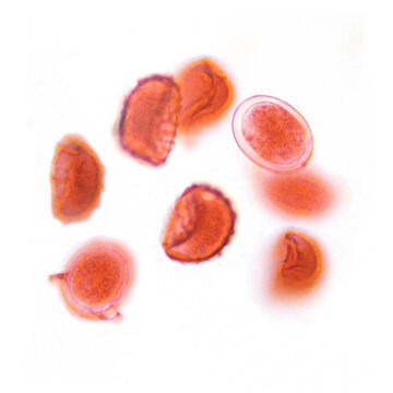 Ascaris is a parasitic nematode that infects humans via the fecal-oral route and resides in the small intestine. Each worm can produce 200,000 eggs per day. Magnify 400x.
