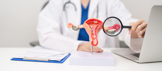 Naklejka premium Doctor with Uterus and Ovaries anatomy model. Ovarian and Cervical cancer, Cervix disorder, Endometriosis, Hysterectomy, Uterine fibroids, Reproductive system, Pregnancy and health concept