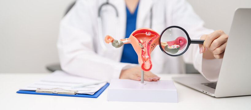 Doctor with Uterus and Ovaries anatomy model. Ovarian and Cervical cancer, Cervix disorder, Endometriosis, Hysterectomy, Uterine fibroids, Reproductive system, Pregnancy and health concept