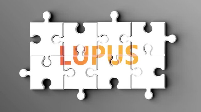 Lupus being a complex topic - puzzle pieces with word lupus coming together to make a whole. Lupus made of many fitting parts, a compound subject.