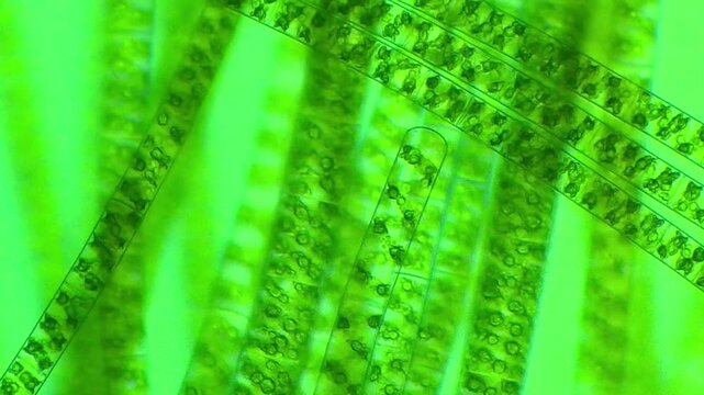 Microscopic view of Spirogyra algae enhanced with food coloring