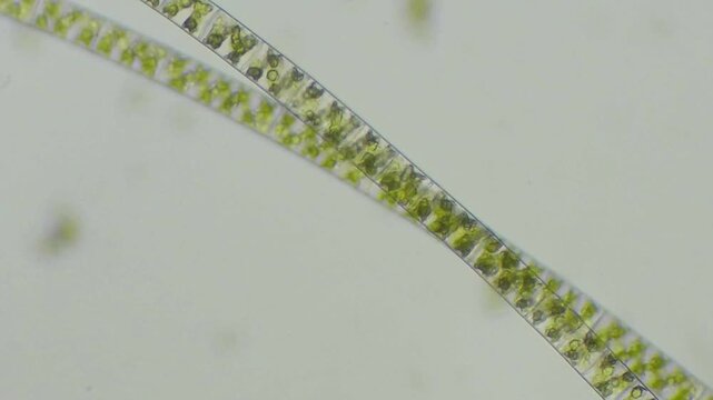 Close-up of a single Spirogyra filament with spiral chloroplasts