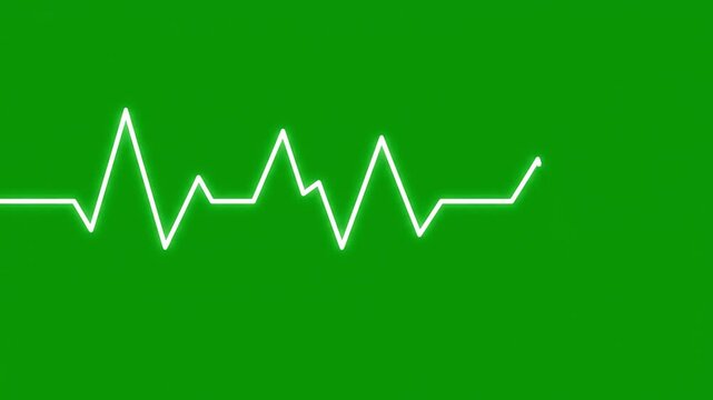 Minimalist Zigzag Line Walking &ndash; Green Screen Simple Motion Path