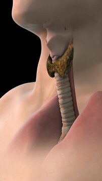 Thyroid gland cancer medical animation