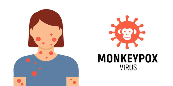 Monkeypox Virus Symptoms and Medical Awareness Graphic