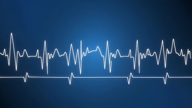 Medical professional analyzing heart rhythm on monitor screen