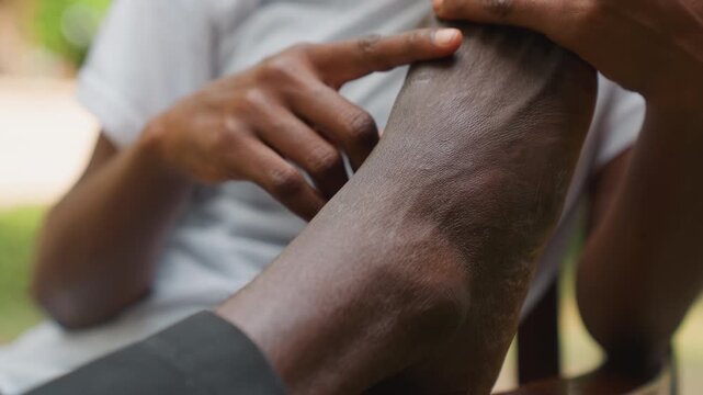 Black partner sunset date leg skin inspection tender reassuring touch of dry patches calm conversation and supportive gesture outdoors closeup of textured skin and comforting hands