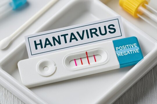 Hantavirus rapid antigen test cassette with positive result on hospital tray