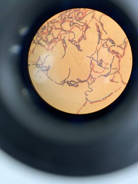 Microscopic view of gram-positive and gram-negative microorganisms observed under a laboratory microscope, showing bacterial structures and microbiology research analysis.