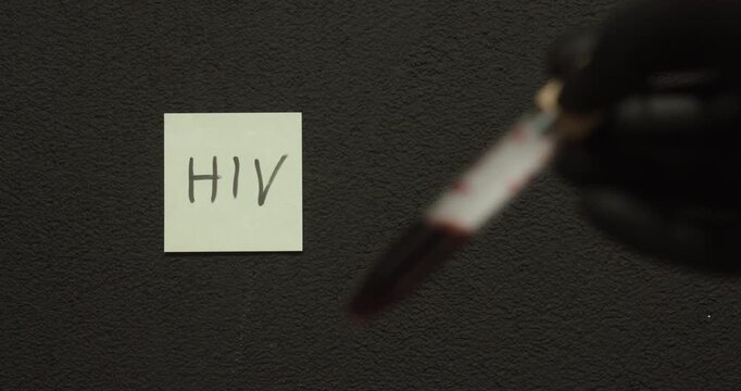 Focus shifts from a blood sample vial to a note labeled &ldquo;HIV,&rdquo; symbolizing medical testing, diagnosis, and awareness.