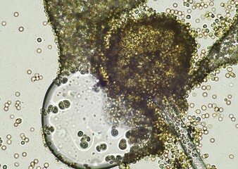 soil microorganisms under a microscope including amoeba, flagellates, nematodes, fungi, bacteria  © ADP