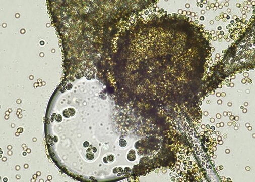 soil microorganisms under a microscope including amoeba, flagellates, nematodes, fungi, bacteria	