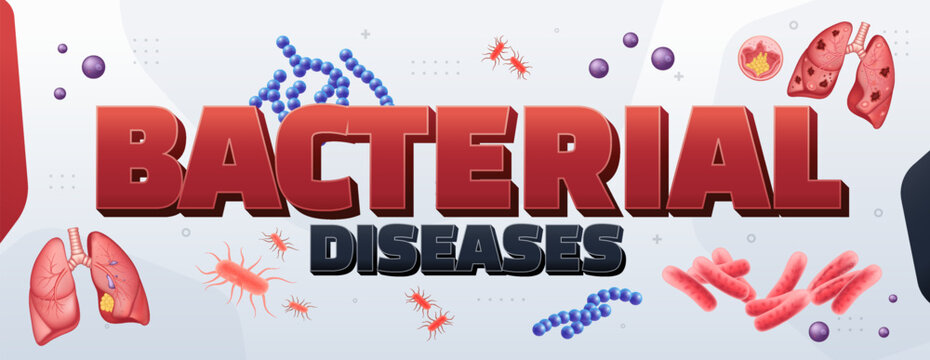 Tuberculosis Medical Educational Infographic