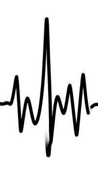 Heart rate line animation with three keyframes shown