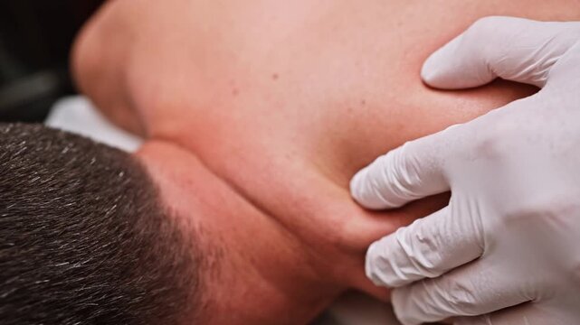 Acupuncturist performing dry needling therapy on man's neck