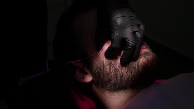 Male patient receiving hyaluronic acid filler injection in cheek