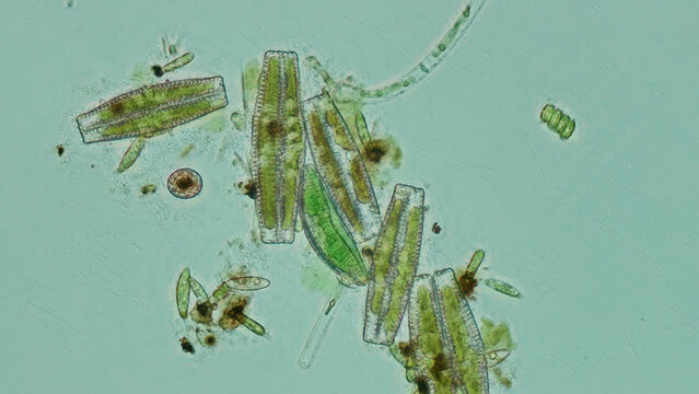 Cymbella Diatoms Under DIC Microscopy