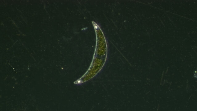 Closterium moniliferum Under Darkfield Microscopy