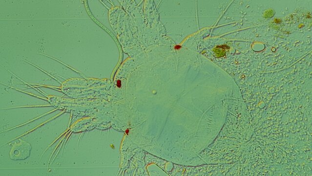 Water Flea Under DIC Microscopy