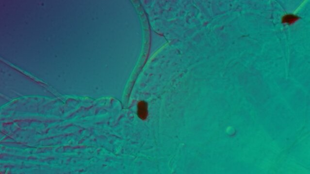 Water Flea Head Under DIC Microscopy