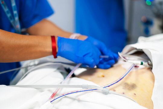 Medical professional attending patient with tubes in intensive care unit