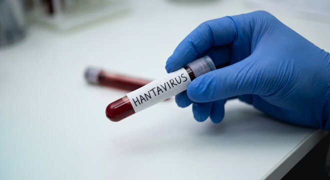 Doctor hand in blue glove holding blood vial sample with Hantavirus title inscription text. Clinical test laboratory and virus diagnosis.