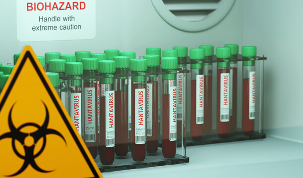 Rows of Hantavirus Blood Samples in Laboratory Storage with Biohazard Warning
