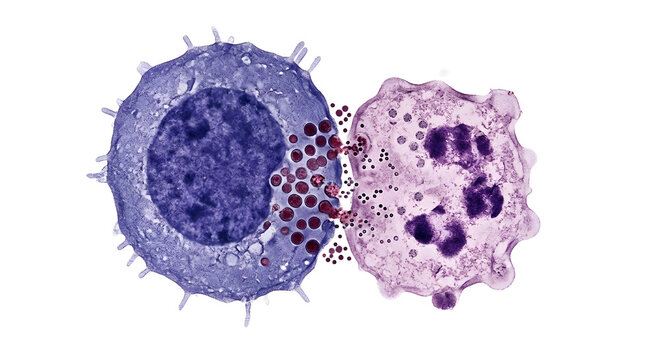3d rendering of a cytotoxic t-cell attaching to and attacking a larger cancer cell, representing immunotherapy and targeted cell destruction