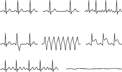 Obraz premium Multiple ecg heartbeat tracings on a medical chart with varying rhythms and patterns