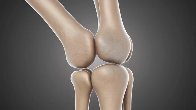 Knee Meniscus Tear with Transparent Joint Overlay Illustrating Cartilage Stress and Load Distribution