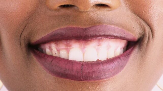 Dental, smile and mouth of woman in studio for teeth whitening, veneers results and cleaning. Healthcare, happy and closeup of person with fresh breath for oral hygiene, dentist care and wellness
