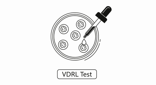VDRL test concept illustration with laboratory pipette and petri dish for syphilis screening.
