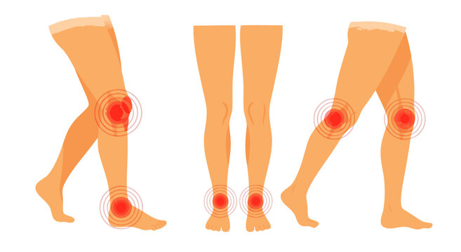Anatomical vector illustration of three human legs in various positions showing knee pain.