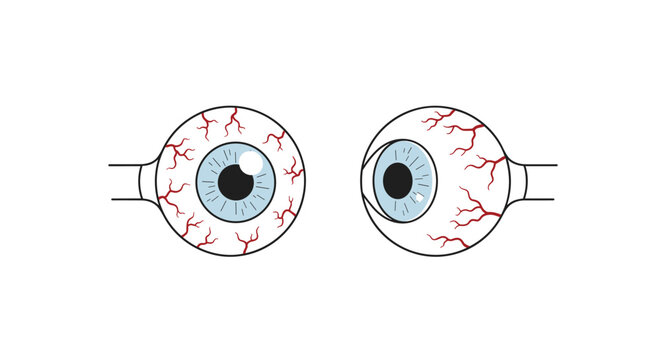 Illustration of two human eyes shows significant redness and visible blood vessels on the sclera against a white background.