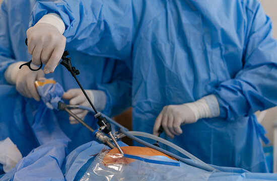 Surgeons performing laparoscopic abdominal surgery with endoscopic tools