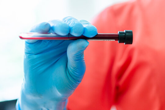 Hantavirus concept. Doctor with face mask holding blood samples in laboratory. Close up.