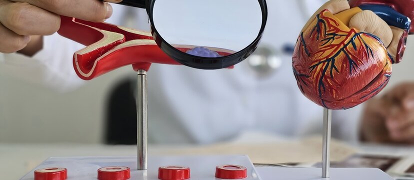 The doctor studies anatomical models of the heart and blood vessels. Angiology is the anatomy of the human