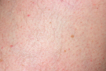 Fototapeta premium Close-up macro view of human skin texture with fine hairs and small blemishes