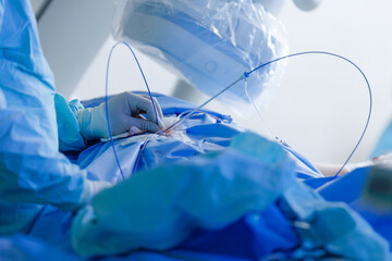 Obraz premium Cardiac catheterization procedure with surgeon hands using catheters and guidewires in sterile operating room for interventional cardiology clinical