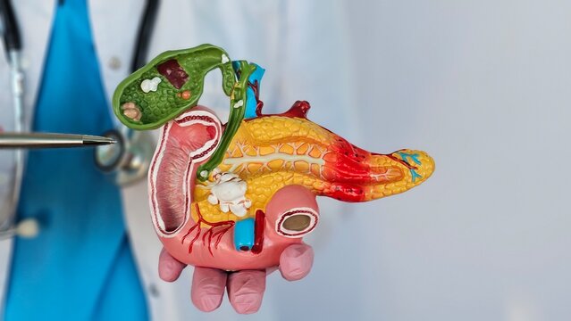 Treatment of gallbladder diseases and cholelithiasis