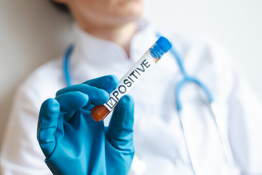 Healthcare worker holds positive test tube in laboratory setting during day shift