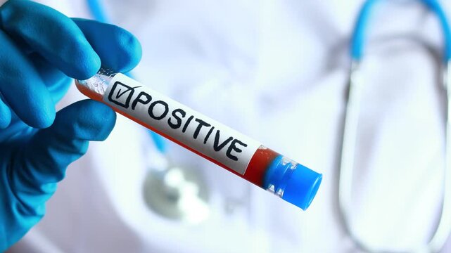Medical professional holds positive test result in laboratory setting during health examination.