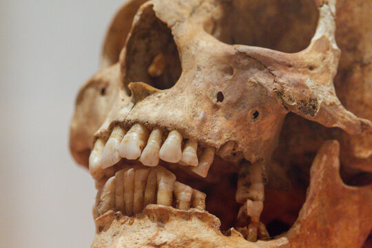 Close-up view of an ancient human skull showing teeth and eye sockets.