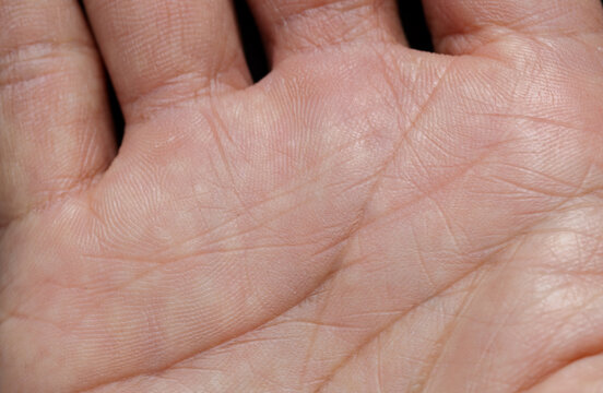 Extreme Close-up of Human Palm Lines and Skin Texture,A high-resolution macro shot showing the intricate details of human palm lines, skin pores, and dermatoglyphics texture. This image highlights.