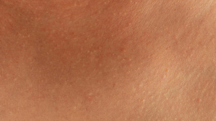 Fototapeta premium Skin texture close up showing surface details on human skin