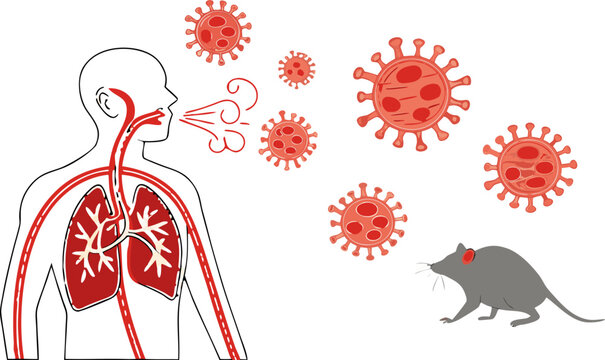 Zoonotic hanta virus illustration showing rodent transmission causing severe pneumonia and respiratory complications.