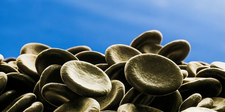 Microscopic view of red blood cells showing normal disc shapes and abnormal sickle shapes indicating sickle cell anemia disease